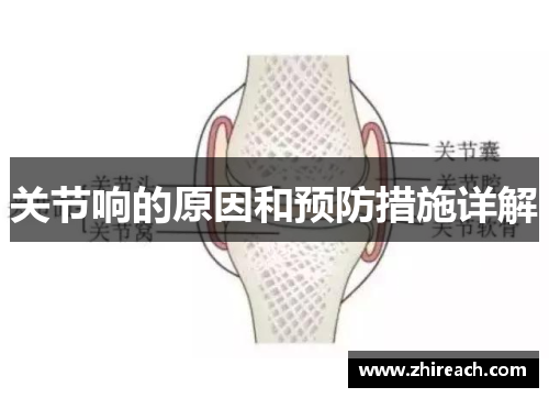 关节响的原因和预防措施详解